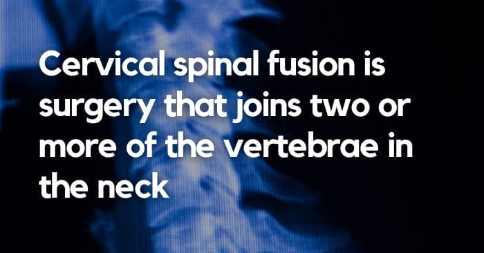 average workers' comp settlement for cervical fusion